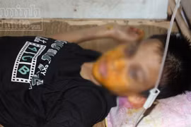 Bắt đối tượng hành hạ cháu bé bị câm bẩm sinh trong khách sạn