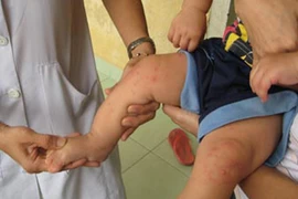 Nguy cơ bùng phát dịch sốt xuất huyết