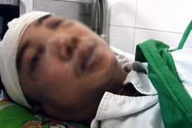 Thuê người đánh dằn mặt đồng nghiệp, 5 đối tượng lãnh án