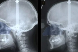 Vì sao mũi đàn ông lớn hơn phụ nữ?