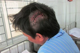 Côn đồ vô cớ vác kiếm chém người nhập viện