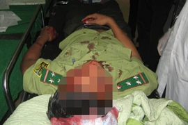 Hàng chục lâm tặc đánh hội đồng 2 kiểm lâm viên