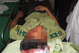 Hàng chục lâm tặc đánh hội đồng 2 kiểm lâm viên