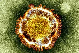 Pháp xác định bệnh nhân thứ 2 nhiễm virus chết người