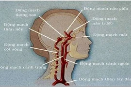 Thường thức về tai biến mạch máu não