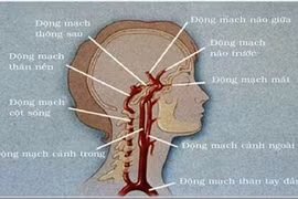 Thường thức về tai biến mạch máu não