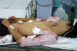 Nhát dao lấy mạng người 