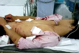 Đối tượng giết người ở ngõ Lò Lợn ra đầu thú