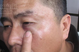 Tranh giành khách, gọi côn đồ đánh dằn mặt tài xế