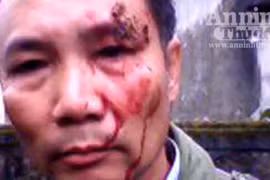 Vừa đến cổng nhà cô dâu thì bị đánh tơi bời