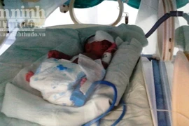 Bé sinh non nặng 500 gam đã tử vong