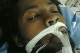 Bị bắn vì trần truồng đột nhập nhà bóp cổ cún cưng