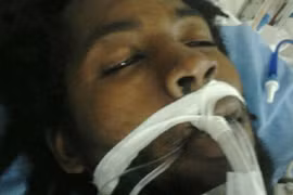 Bị bắn vì trần truồng đột nhập nhà bóp cổ cún cưng