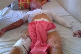 Tưới xăng đốt vợ vì không dậy đi làm đồng