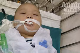 Phẫu thuật thành công cho bé 9 tháng tuổi bị xương đâm thủng ruột