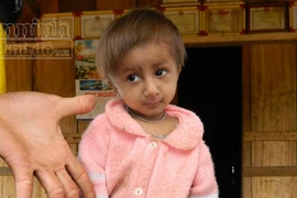 Đưa chú bé “tí hon” điều trị tuyến tỉnh