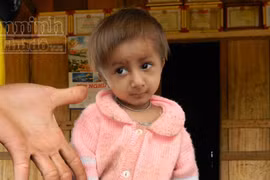 Đưa chú bé “tí hon” điều trị tuyến tỉnh