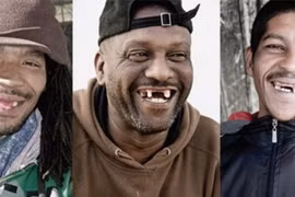 Nơi đàn ông đua nhau… nhổ răng cửa