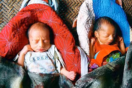 Kỳ lạ ngôi làng có hơn 100 cặp song sinh