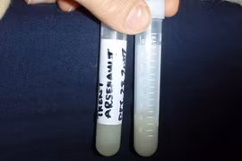 Bị ép phải chu cấp tiền nuôi con sau khi hiến tinh trùng