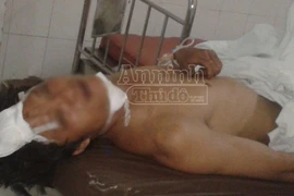 Chồng chém chết vợ rồi tự cứa cổ, uống thuốc độc tự tử