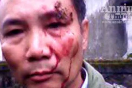 Vừa đến cổng nhà cô dâu thì bị đánh tơi bời