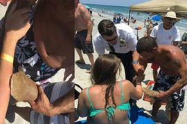 Nhập viện với cá mập dính trên tay