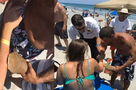 Nhập viện với cá mập dính trên tay