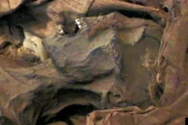 Phát hiện xác ướp cổ bị ung thư tiền liệt tuyến