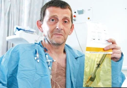 10 năm sống với dĩa nhựa trong bụng