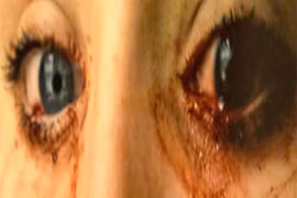 Thiếu nữ khóc ra máu 