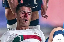 Ronaldo mặt đầm đìa máu trong chiến thắng của ĐT Bồ Đào Nha