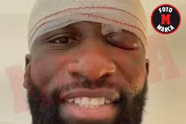 Fan Real nhói lòng với hình ảnh Rudiger trước trận Siêu kinh điển