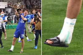 Chelsea tổn thất lớn sau khi vô địch thế giới