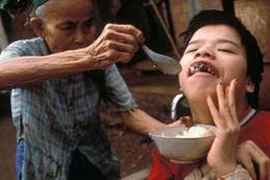 50 năm thảm họa da cam