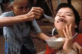 50 năm thảm họa da cam