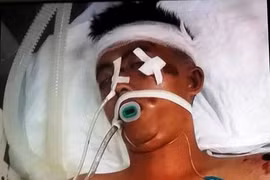 Tìm nhân thân nam thanh niên bị tai nạn nguy kịch