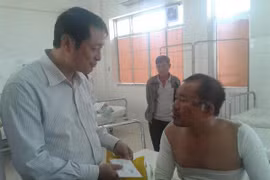 Cháy nổ tại nhiệt điện Vĩnh Tân 4: Nạn nhân bị bỏng đến 12%