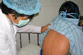 Nhiều bệnh nhân nguy kịch do côn trùng đốt