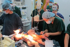 Tách rời thành công 2 trẻ sinh đôi 4 tháng tuổi