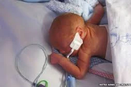 Sự sống 36 ngày