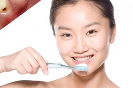 Bệnh từ miệng mà ra