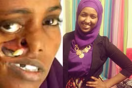 Tìm được khuôn mặt sau 23 năm “đánh mất”