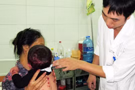 Hà Nội: Bệnh thủy đậu vào mùa