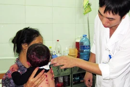 Hà Nội: Bệnh thủy đậu vào mùa