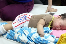 Cách nhận biết và phòng ngừa bệnh sởi