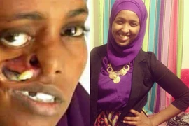 Tìm được khuôn mặt sau 23 năm “đánh mất”