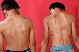 Bắt 7 đối tượng “cướp máu” trẻ em