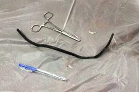 Thách đố nhau, nuốt sợi dây điện gần 40cm