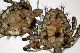 Rận mu tấn công bộ phận sinh dục